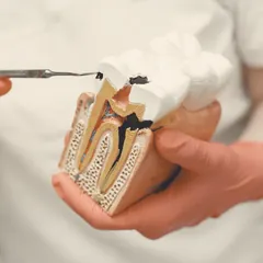 Maqueta de un diente en corte que muestra el conducto radicular